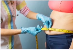 tummy tuck Adelaide 