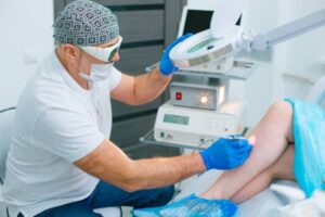 varicose vein treatment Adelaide